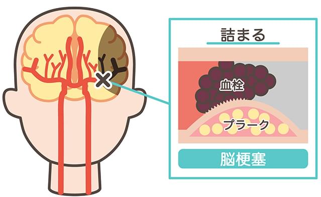 禁煙外来🚬 | 春日駅前あべファミリークリニック内科 脳外科 整形外科【公式】文京区