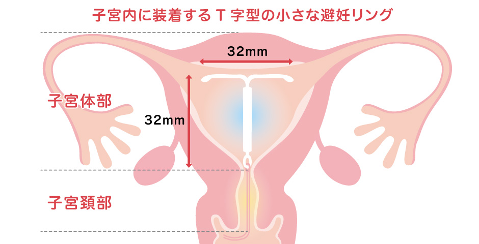 入り浸りJKにアソコ使わせてもらう話｜まんが王国