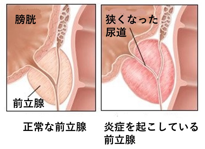 大人のためのアナルバイブレーター,前立腺マッサージ,お尻,男性のマスターベーター,裏庭のプラグ,セックス製品 - AliExpress