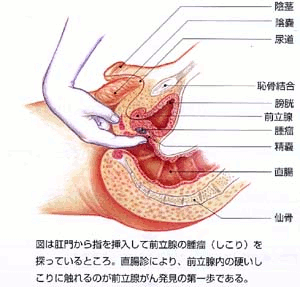 アプリ操作×リモコン操作 振動×ピストン 前立腺責め シリコン製