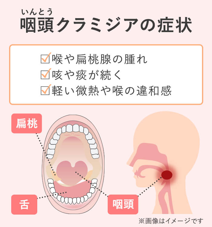 感染経路とリスク（カンジダ）｜白っぽいおりもの、発疹や痒みを感じたら｜性病検査（大阪・京都・三宮）｜性病ドットコム