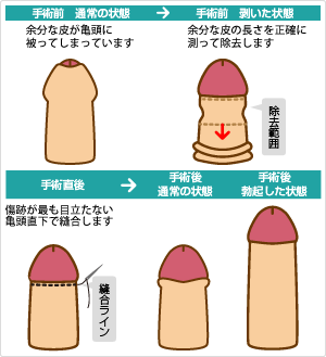 ドエロい舌使い＆生ハメセックスで包茎治療！セクシーなアナコンダ舌が包皮をムキムキ！『佐伯由美香のディープスロート包茎クリニック』見どころ紹介レビュー！  |