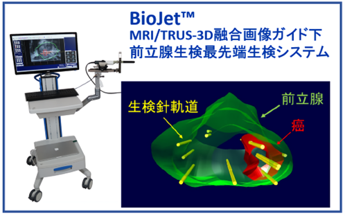 前立腺生検システムを導入しました｜筑波学園病院