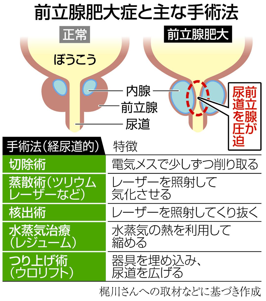 エルフ 荒川 on X: