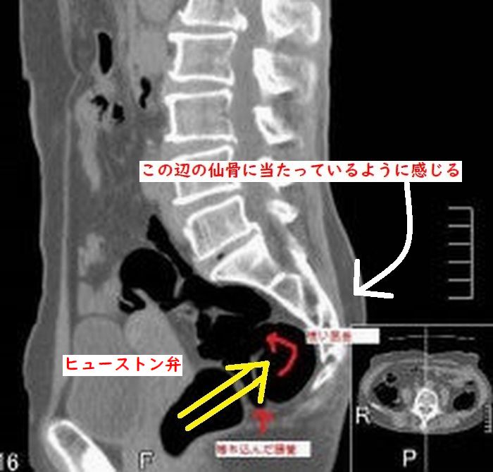 女性の脚ピン（足ピン）オナニーについて - TENGAヘルスケア プロダクトサイト