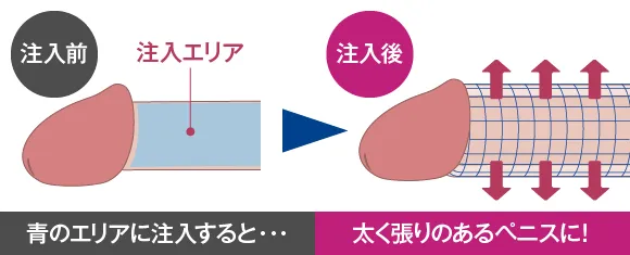 泌尿器科の専門医が解説】ペニスを大きくする方法〜自力・サプリ・器具・手術〜