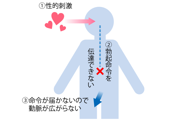 EDの症状は？「勃起しない」だけじゃない！注意したい予兆と治し方 |【公式】ユナイテッドクリニック