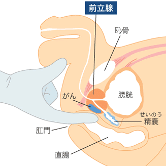 創作BLオタクさん、【前立腺を触る時の体位や触った時の感触】知りたくない？｜BLニュース ちるちる