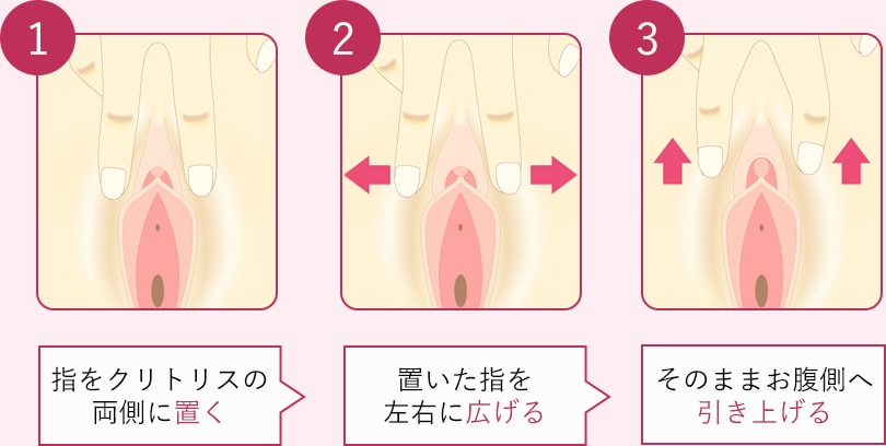 ビラビラ(小陰唇)が大きい原因は？平均や小さくする方法を解説 | 銀座マイアミ美容外科