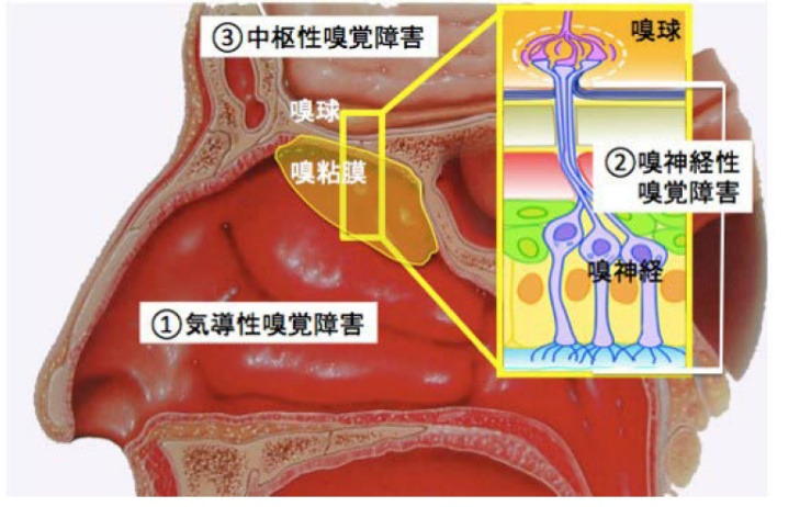 たばこと健康】喫煙も味覚・嗅覚障害を招く（1/2ページ） - 産経ニュース