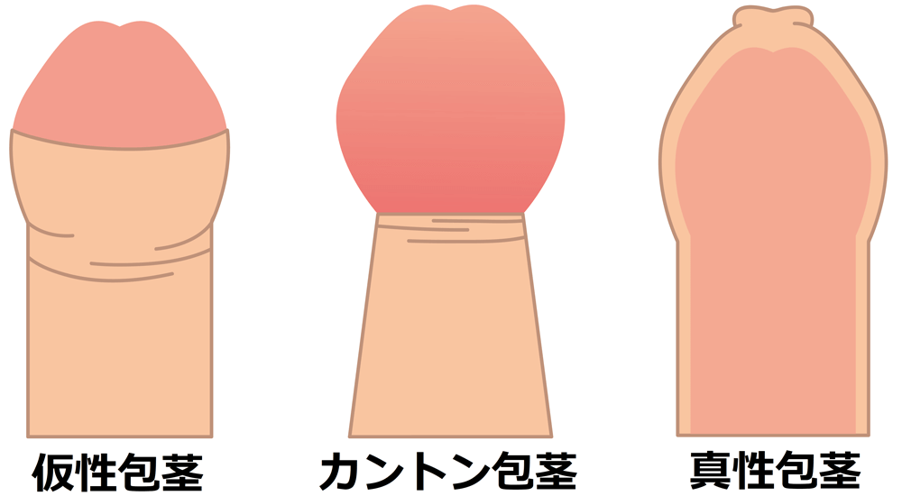 Dクリニックメンズヘルス【公式】-ED・男性更年期治療・男性の健康専門外来