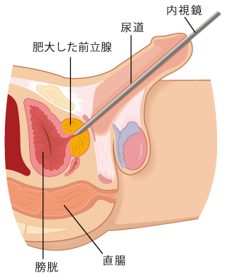 スタッフブログ：前立腺のメスイキを簡単に！ | アネロスジャパン | ANEROS