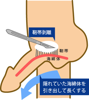 ヒトの陰茎のサイズ - Wikipedia