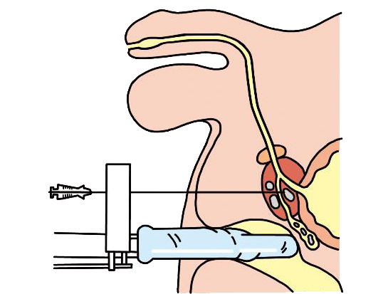 前立腺責めのやり方とコツ！気持ちいい前立腺マッサージの方法をイラストで解説