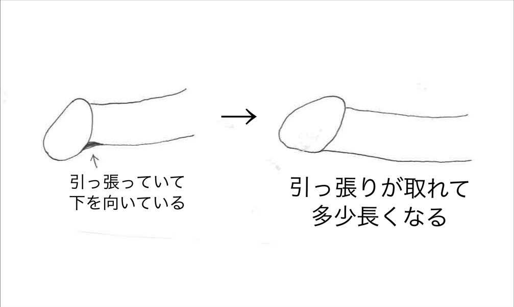 亀頭バイブ 20種激震 尿道×裏筋同時責め 強力ローター トレーニング用