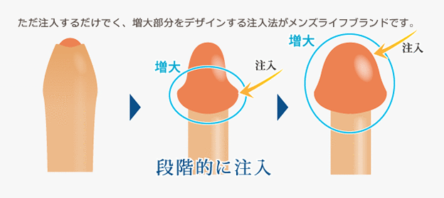 男性器のサイズアップの方法でやっても効果のない3つの方法とは？ –メンズクリニック研究会-包茎