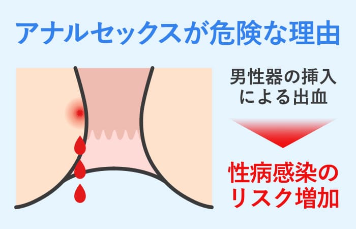 アナルセックスの快感と正しいやり方完全マニュアル】男女共通の開発法 | 【きもイク】気持ちよくイクカラダ