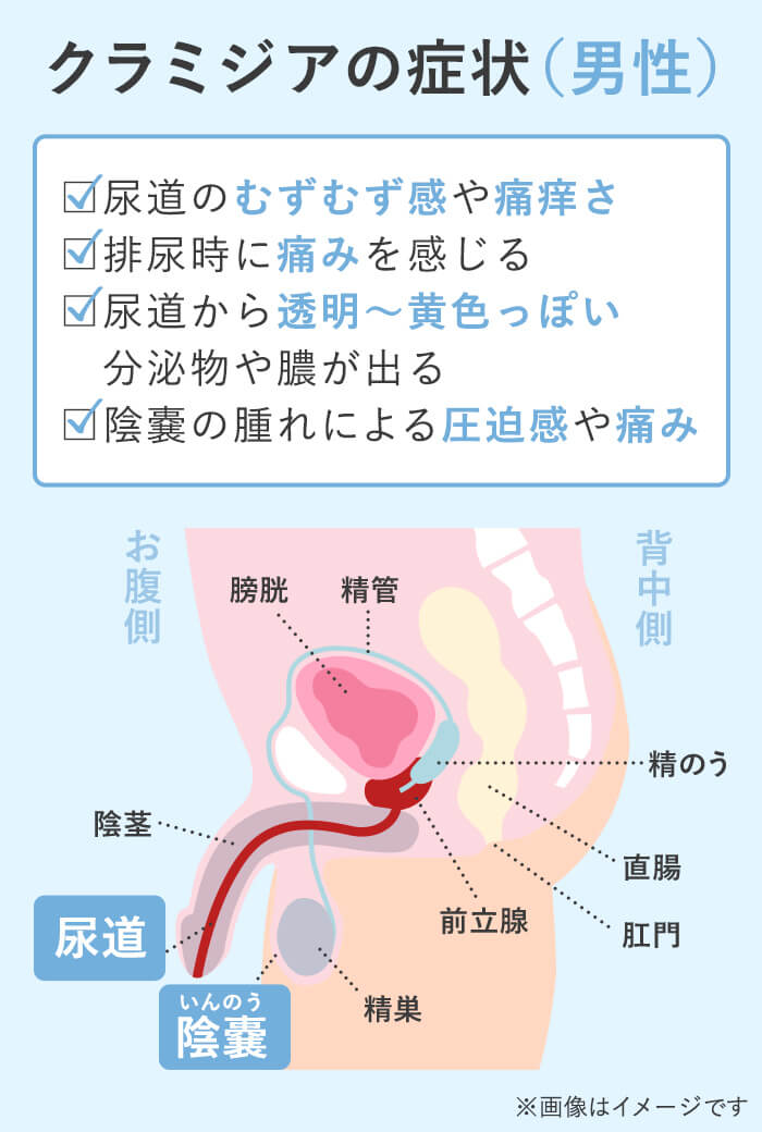 カンジダ｜東京・性感染症内科｜銀座ヒカリクリニック