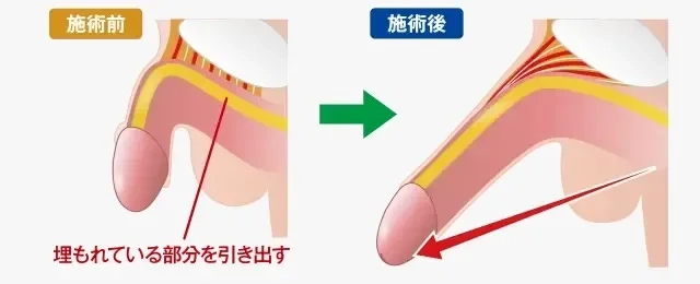 痴漢記録日記 vol.22制服娘特大版】被害者全てが女子校生 |