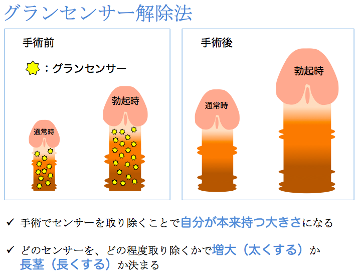 短小包茎とは！短小は何センチから？日本人の平均サイズや治療法 - アトムクリニック - atom-clinic