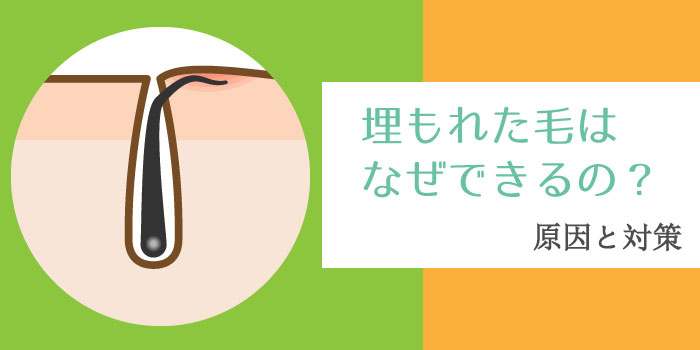 毛抜きでも毛根は死ぬ？やり方と脱毛との関係・痛くない方法は？ | 内科総合クリニック人形町