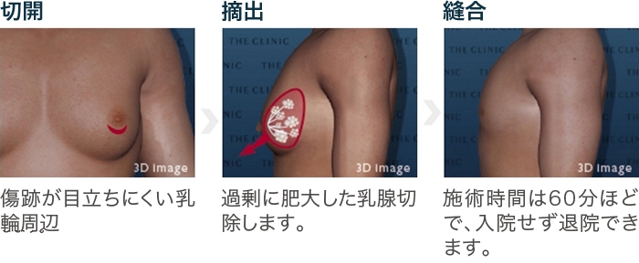 それ、乳首ポコ？！男性の乳首対策がこんなにも急務だとは・・夏の薄着で乳首が透けている男性は要チェックです！ - たまごごはん