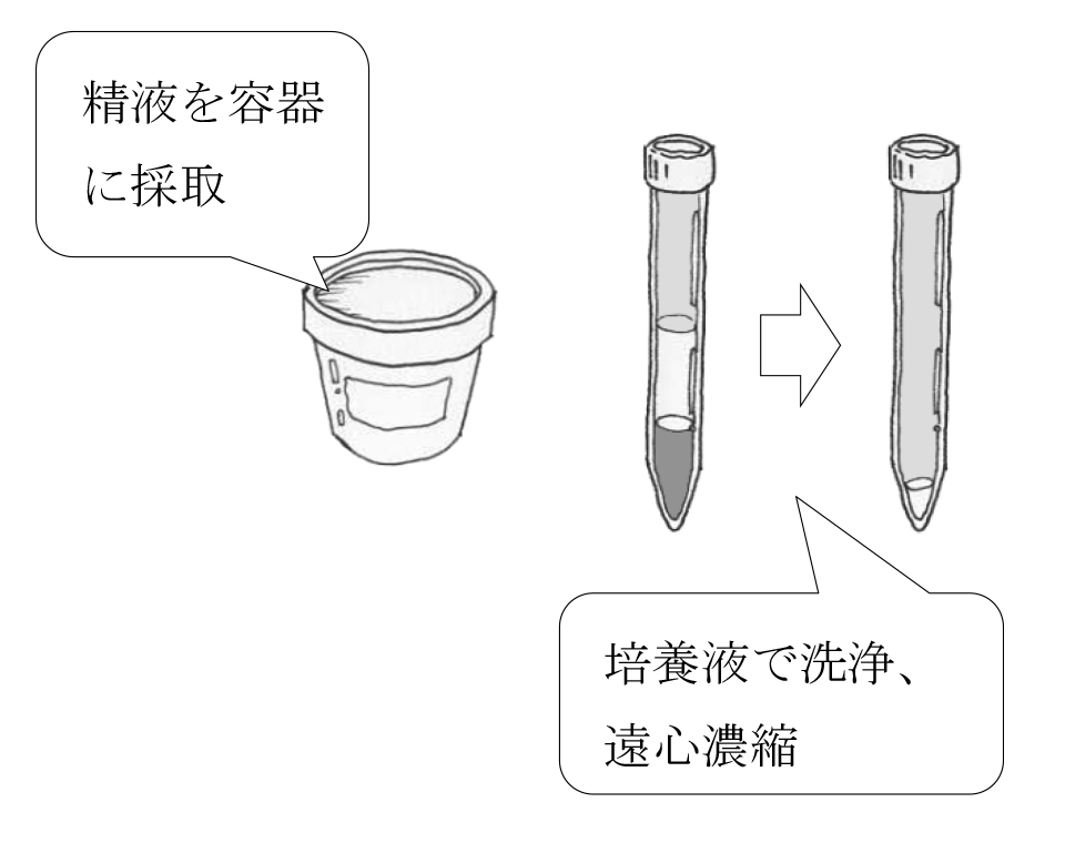 Amazon.co.jp: 吐かない過食の治し方: 5つの小さな習慣で思考改革と食事改善を同時に叶える eBook :