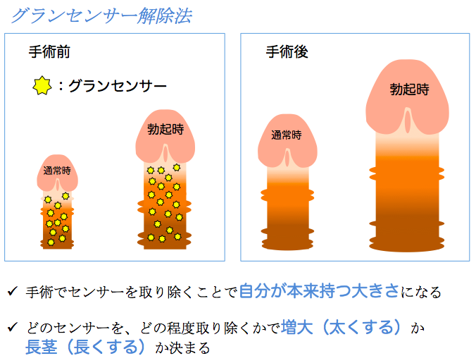 ペニス増大・陰茎増大｜MSクリニック