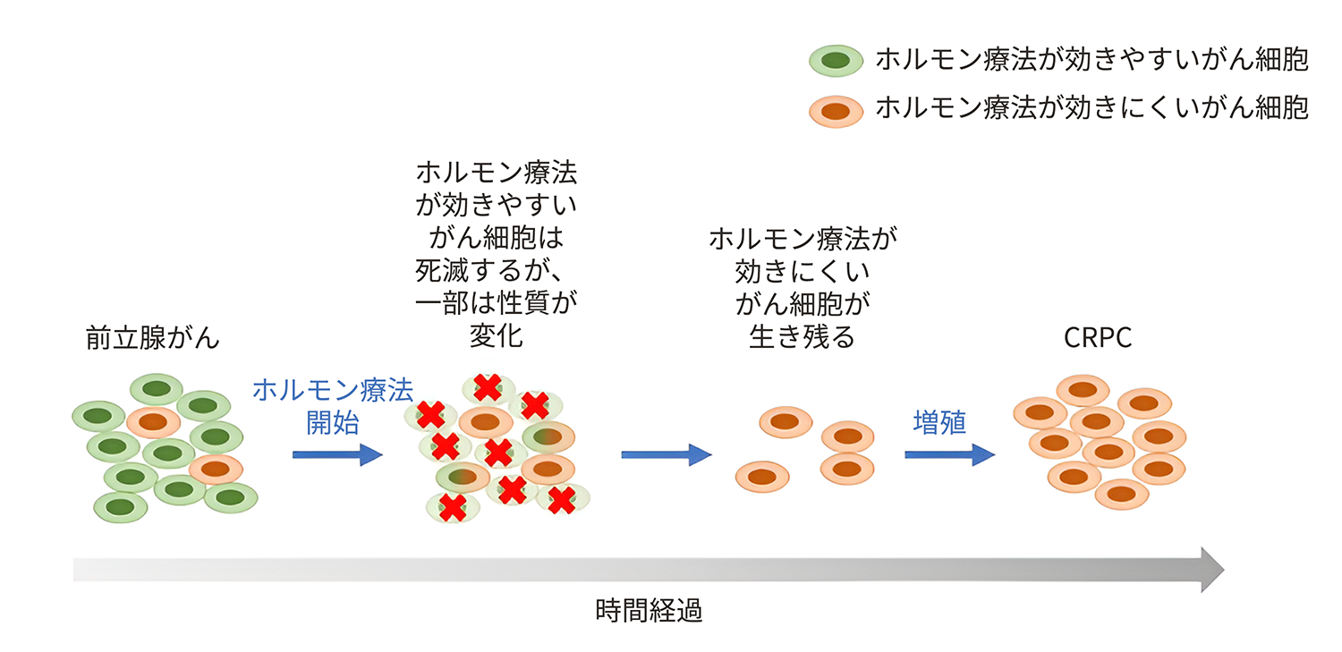 前立腺とは？｜前立腺がんについて｜What's? 前立腺がん