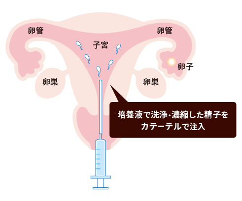 まだ奥まで入れるの | 写真で一言ボケて(bokete)