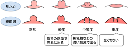 哺乳瓶ちくびの人気おすすめ11選【種類や消毒方法から選ぶ】寿命はいつ？ | マイナビおすすめナビ