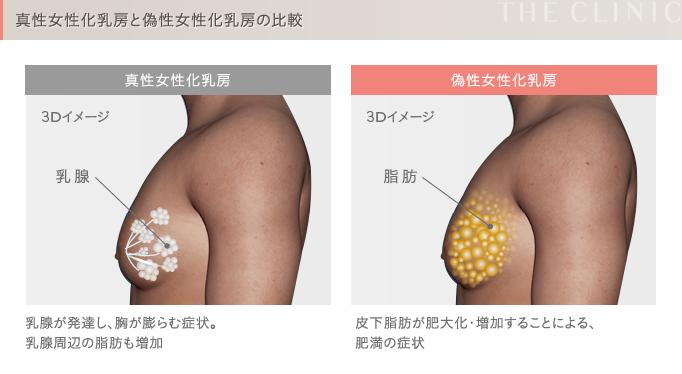 気になる男の皮下脂肪を効率的に燃焼させる方法2選 | 男のためのダイエットマニュアル