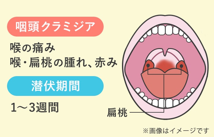 性病はうつる？フェラ等の感染経路と予防法 - 夜の保健室