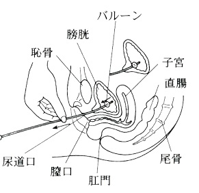 210402][調教日記]素人調教ドキュメンタリー 【激レア】初めての尿道プレイにマゾ泣き、強○排尿を試みるも空気が流入し前代未聞の前々（尿道）おならを豪快に発し羞恥する  淫乱OL