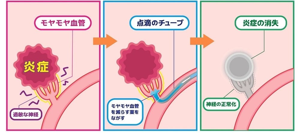 風俗嬢必見！お客さんが喜ぶ前立腺の責め方のコツを伝授 - ぴゅあじょDiary